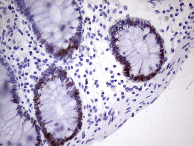 MCM2 Antibody in Immunohistochemistry (Paraffin) (IHC (P))