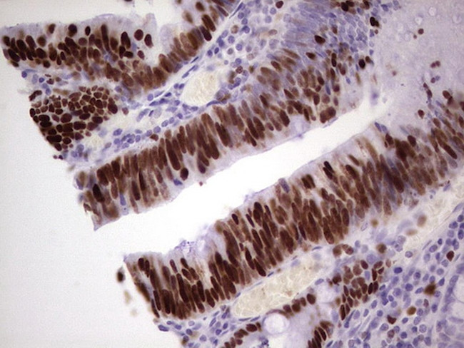 MCM2 Antibody in Immunohistochemistry (Paraffin) (IHC (P))