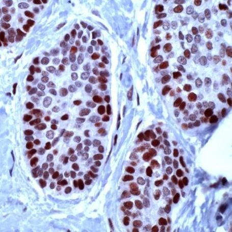 MCM2 Antibody in Immunohistochemistry (IHC)