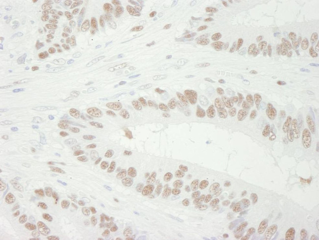 MCM3 Antibody in Immunohistochemistry (IHC)