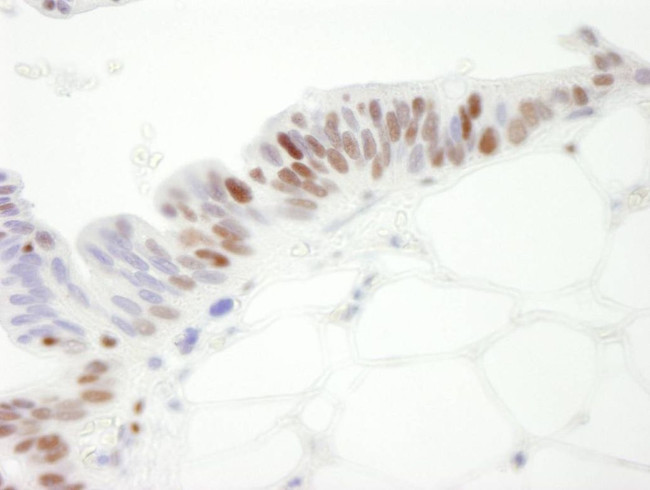 MCM3 Antibody in Immunohistochemistry (IHC)