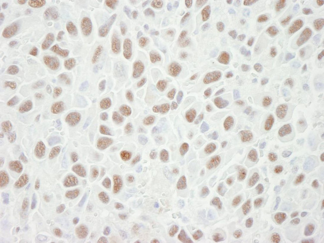 MCM6 Antibody in Immunohistochemistry (IHC)