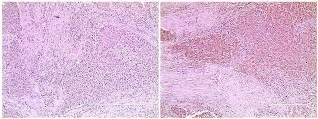 MDM2 Antibody in Immunohistochemistry (Paraffin) (IHC (P))