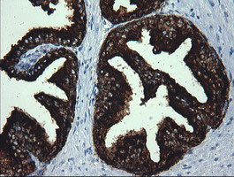 MDM4 Antibody in Immunohistochemistry (Paraffin) (IHC (P))