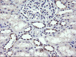 MDM4 Antibody in Immunohistochemistry (Paraffin) (IHC (P))