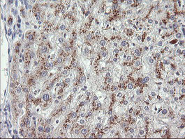 MDM4 Antibody in Immunohistochemistry (Paraffin) (IHC (P))