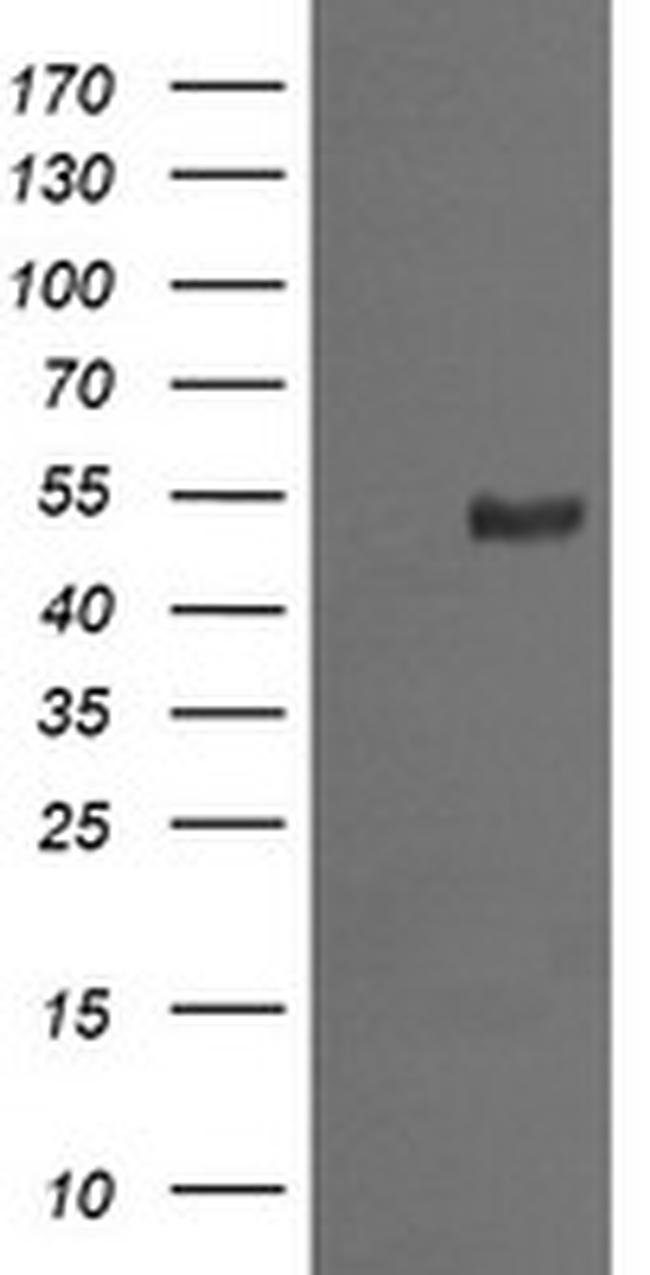 MDM4 Antibody in Western Blot (WB)