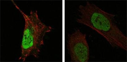 MDMX Antibody in Immunocytochemistry (ICC/IF)