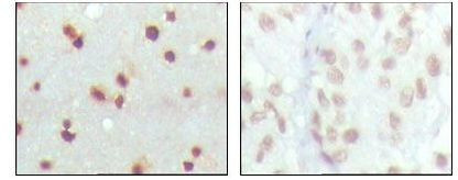 MDMX Antibody in Immunohistochemistry (Paraffin) (IHC (P))
