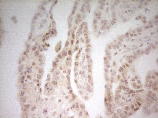 MED15 Antibody in Immunohistochemistry (Paraffin) (IHC (P))