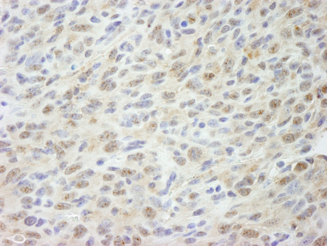 MED18 Antibody in Immunohistochemistry (IHC)