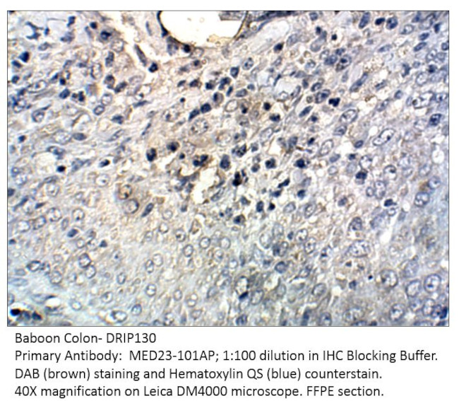 DRIP130 Antibody in Immunohistochemistry (IHC)