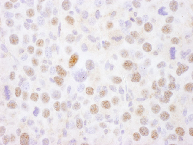 MEF2A Antibody in Immunohistochemistry (IHC)