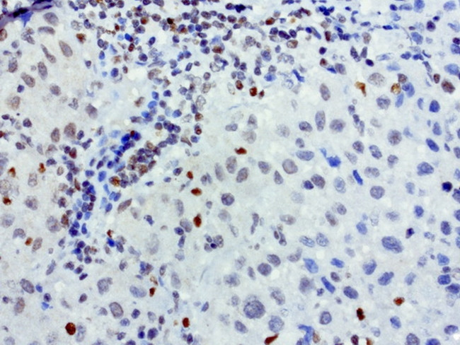 MEF2C Antibody in Immunohistochemistry (Paraffin) (IHC (P))