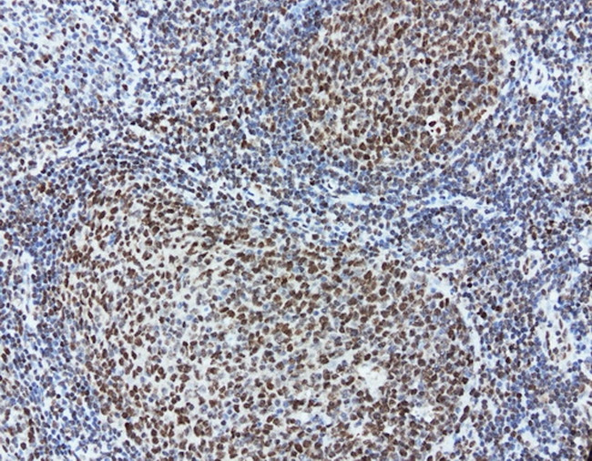 MEF2C Antibody in Immunohistochemistry (Paraffin) (IHC (P))