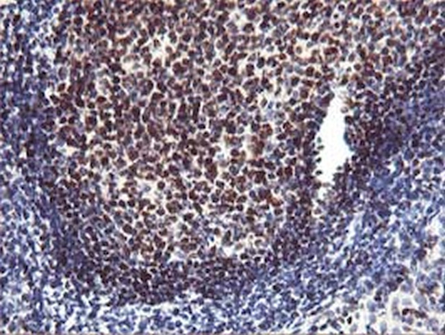 MEF2C Antibody in Immunohistochemistry (Paraffin) (IHC (P))