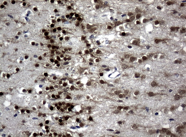 MEF2C Antibody in Immunohistochemistry (Paraffin) (IHC (P))