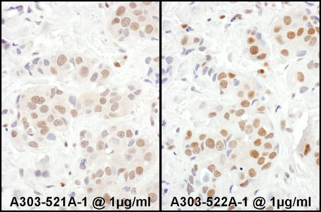 MEF2D Antibody in Immunohistochemistry (IHC)