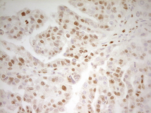 MEF2D Antibody in Immunohistochemistry (Paraffin) (IHC (P))