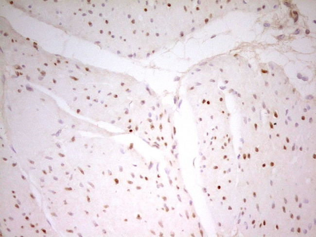 MEF2D Antibody in Immunohistochemistry (Paraffin) (IHC (P))