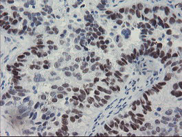 MEIS3 Antibody in Immunohistochemistry (Paraffin) (IHC (P))