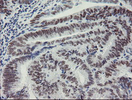 MEIS3 Antibody in Immunohistochemistry (Paraffin) (IHC (P))