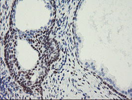 MEIS3 Antibody in Immunohistochemistry (Paraffin) (IHC (P))