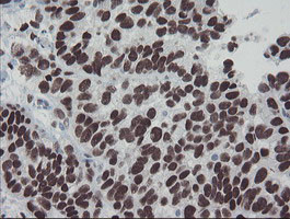 MEIS3 Antibody in Immunohistochemistry (Paraffin) (IHC (P))