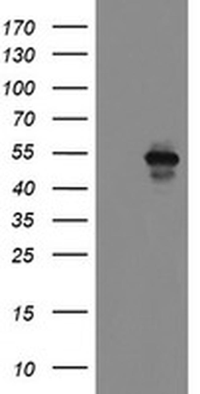 MEIS3 Antibody in Western Blot (WB)