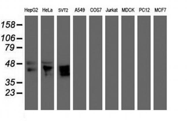 MEIS3 Antibody in Western Blot (WB)