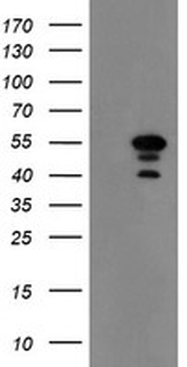 MEIS3 Antibody in Western Blot (WB)