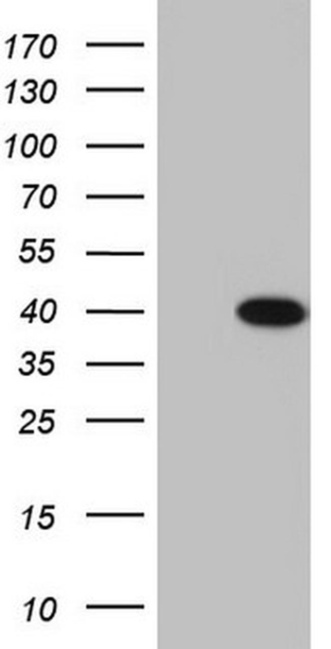 MEOX1 Antibody in Western Blot (WB)