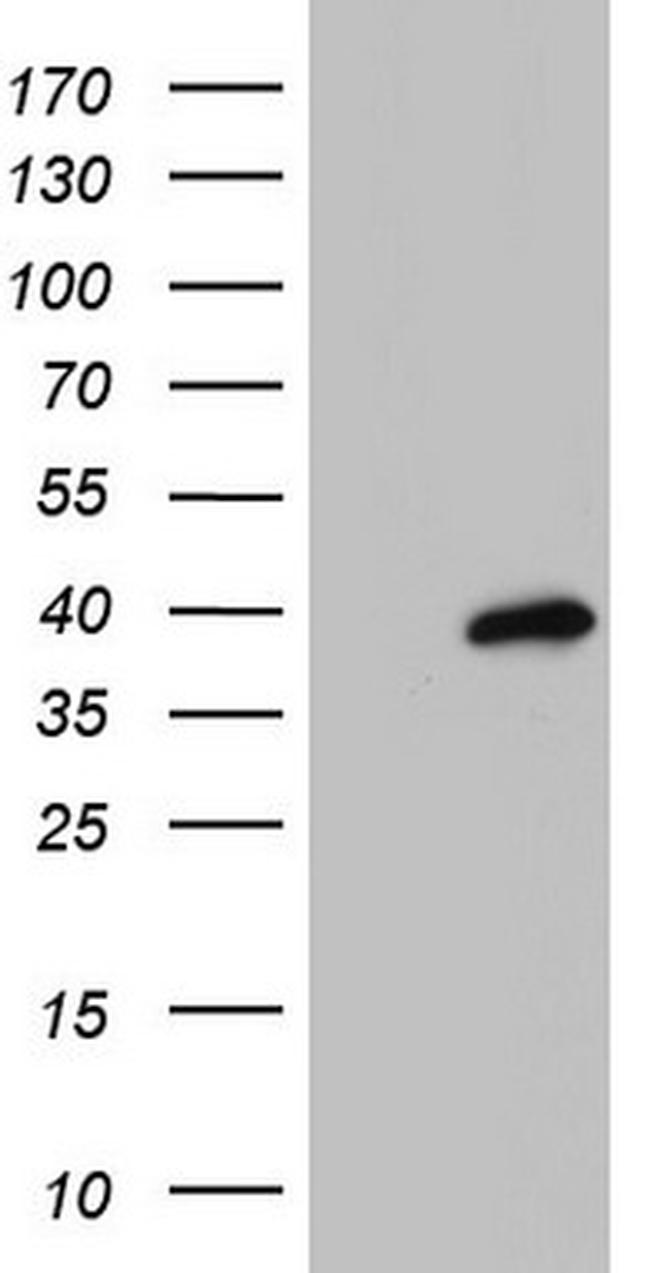 MEOX1 Antibody in Western Blot (WB)