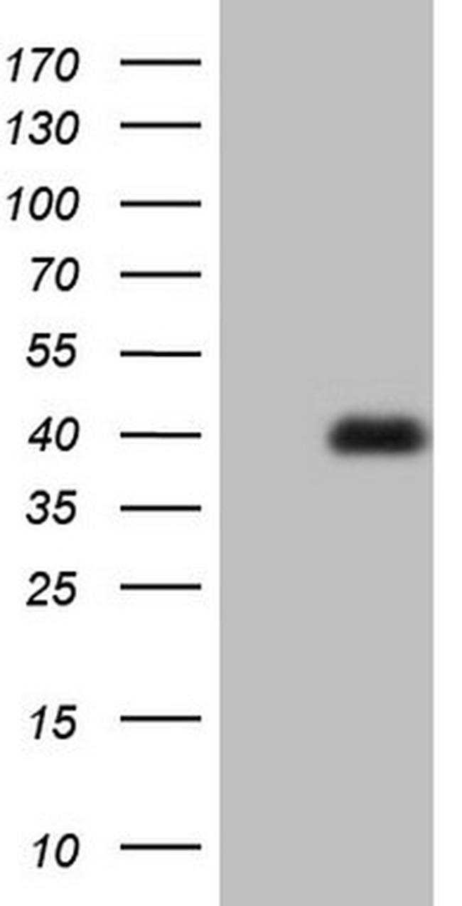 MEOX1 Antibody in Western Blot (WB)