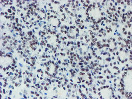 METT10D Antibody in Immunohistochemistry (Paraffin) (IHC (P))