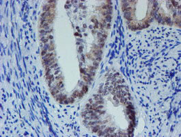 METT10D Antibody in Immunohistochemistry (Paraffin) (IHC (P))