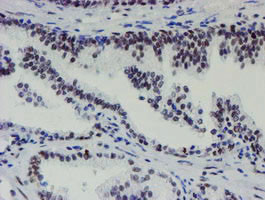 METT10D Antibody in Immunohistochemistry (Paraffin) (IHC (P))