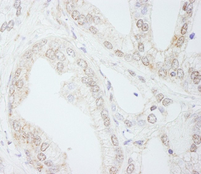 METTL3/MT-A70 Antibody in Immunohistochemistry (IHC)