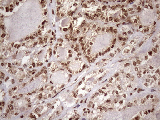 MGC12965 Antibody in Immunohistochemistry (Paraffin) (IHC (P))