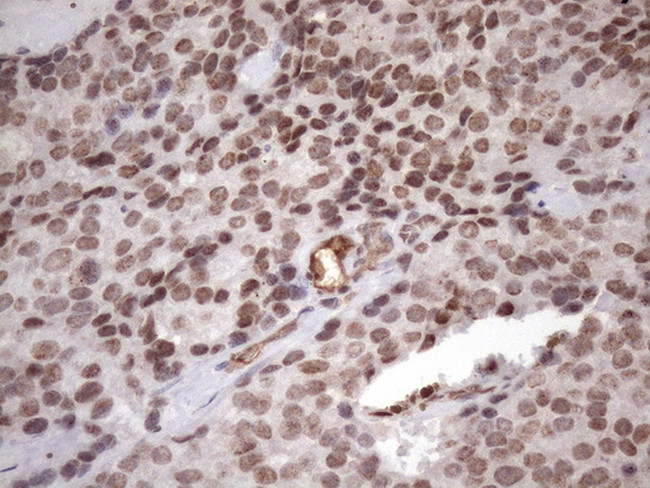 MGC12965 Antibody in Immunohistochemistry (Paraffin) (IHC (P))