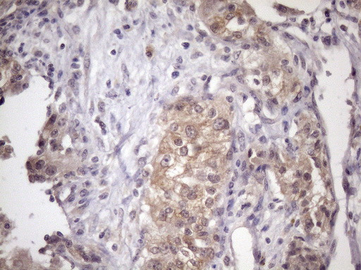 MGC12965 Antibody in Immunohistochemistry (Paraffin) (IHC (P))