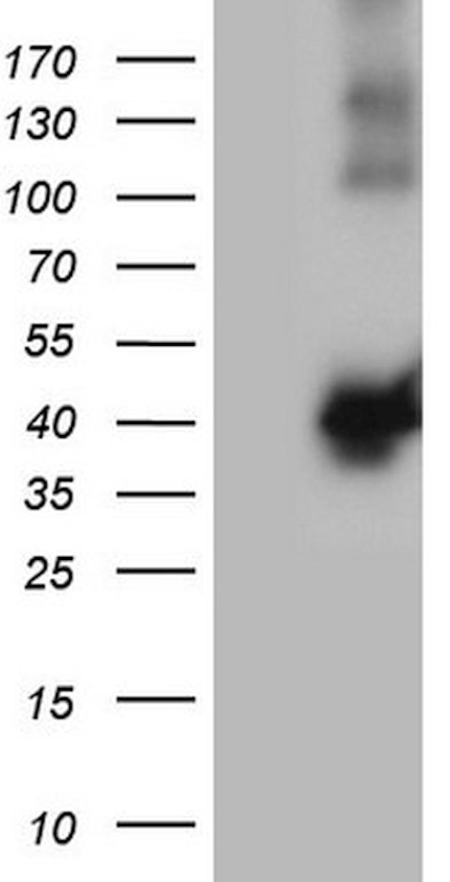 MGC12965 Antibody in Western Blot (WB)