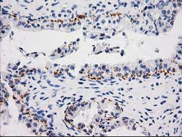 MGLL Antibody in Immunohistochemistry (Paraffin) (IHC (P))