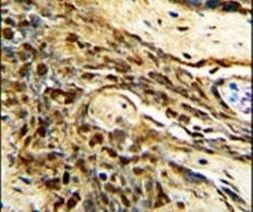 MGMT Antibody in Immunohistochemistry (IHC)