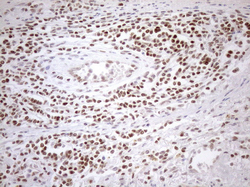 MGMT Antibody in Immunohistochemistry (Paraffin) (IHC (P))