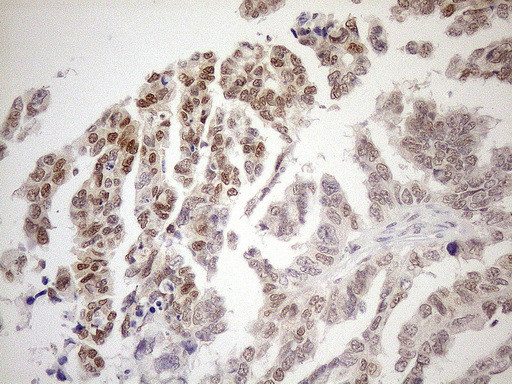 MGMT Antibody in Immunohistochemistry (Paraffin) (IHC (P))