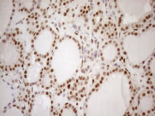 MGMT Antibody in Immunohistochemistry (Paraffin) (IHC (P))