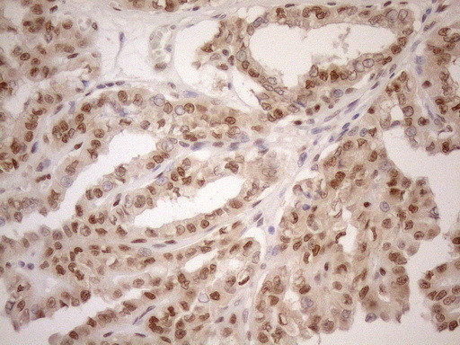 MGMT Antibody in Immunohistochemistry (Paraffin) (IHC (P))