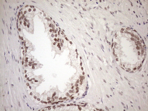 MGMT Antibody in Immunohistochemistry (Paraffin) (IHC (P))