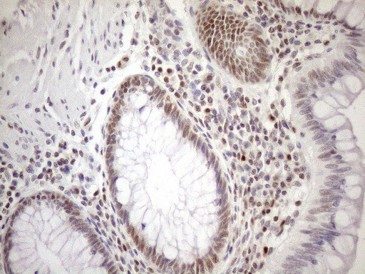 MGMT Antibody in Immunohistochemistry (Paraffin) (IHC (P))